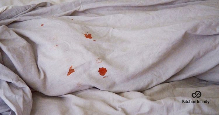how to remove blood stains from white sheets
